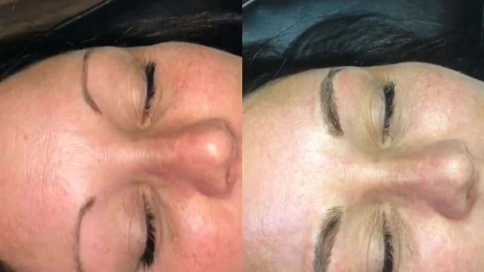 MICROBLADING TRANSFORMATION